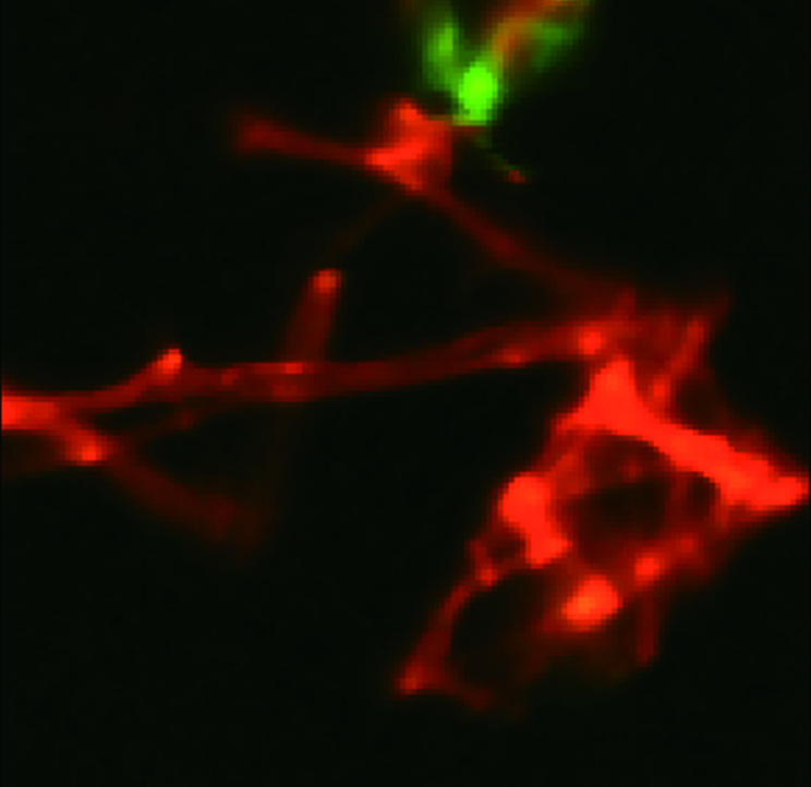 TiO2 Raman chemical imaging result